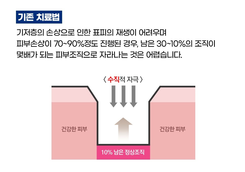 기존 여드름흉터 치료의 한계