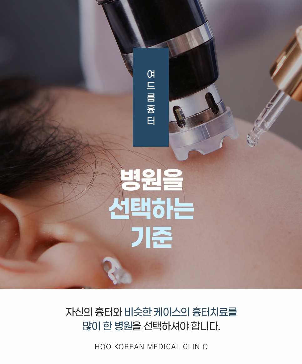 여드름흉터 병원 선택 기준