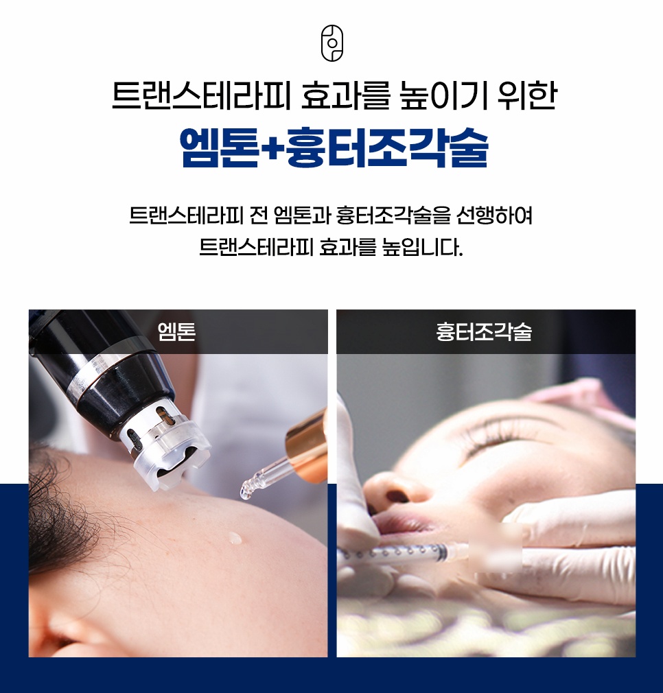 트랜스테라피 효과를 높이는 엠톤과 흉터조각술 시술 장면