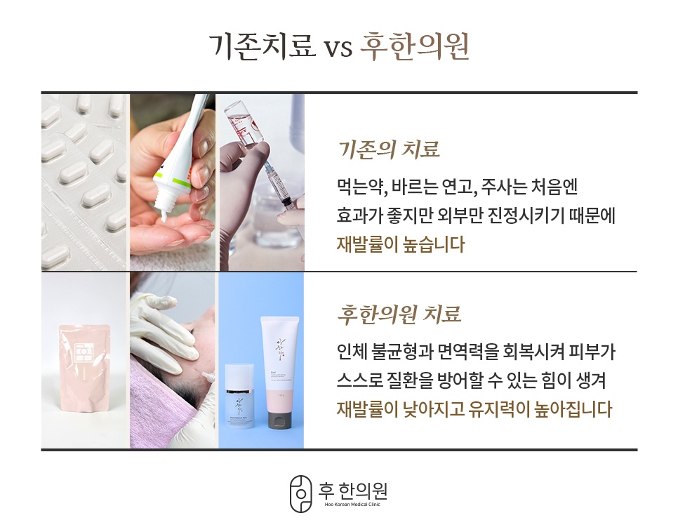 기존치료와 후한의원 치료 비교, 재발률과 유지력 차이 설명