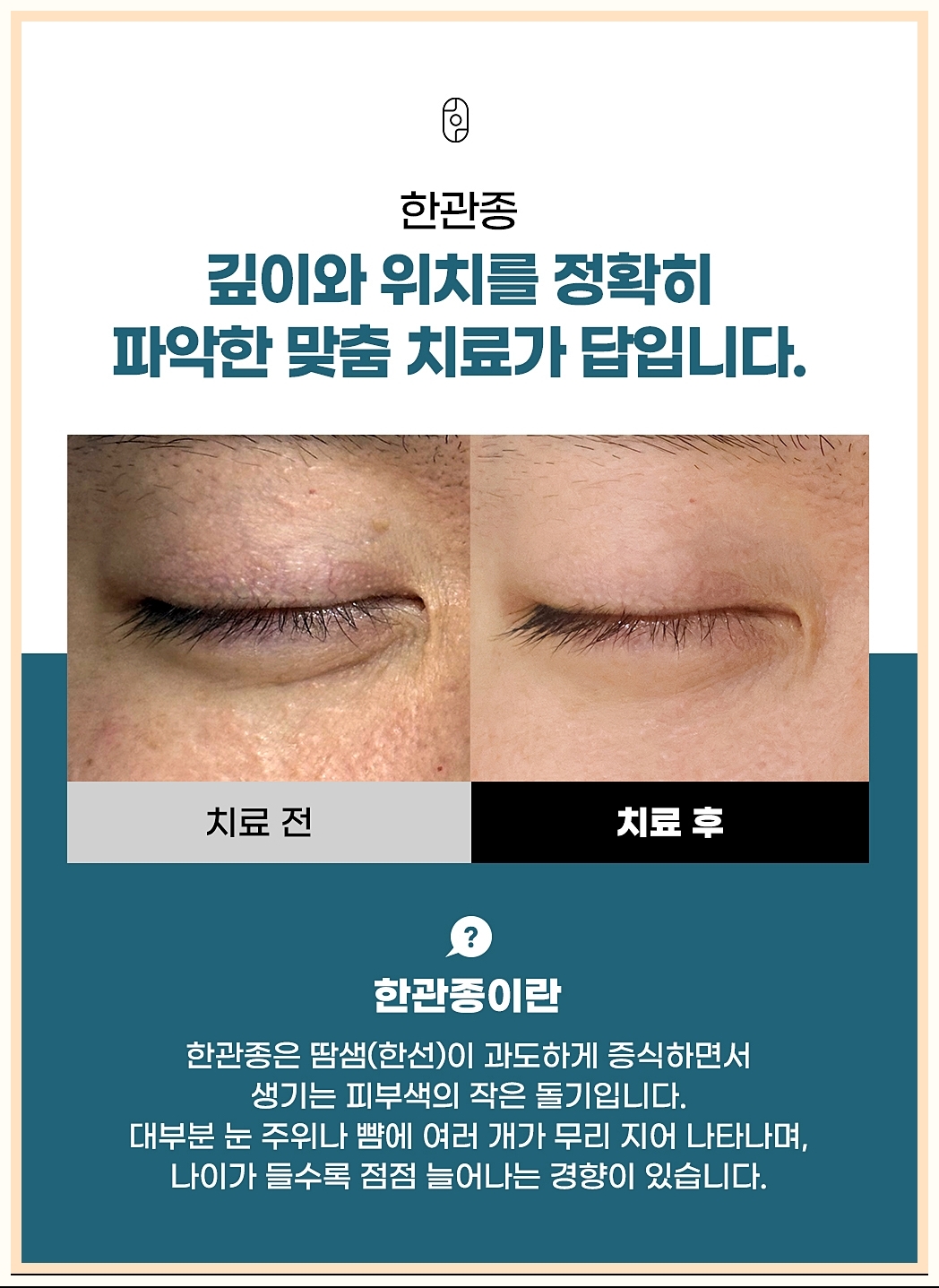 한관종이라는 질환에 대한 정의 내용