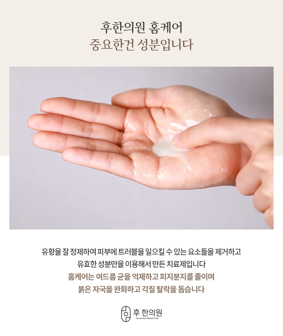 손바닥에 덜어낸 후한의원 홈케어 유황 성분 치료제
