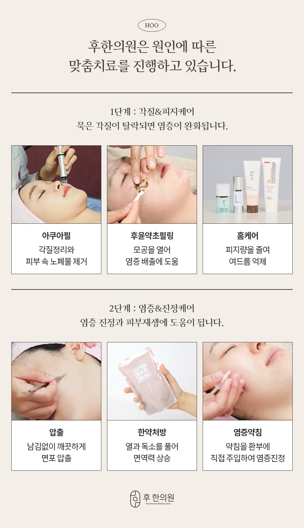 후한의원 여드름 원인별 맞춤치료 1단계 각질피지케어, 2단계 염증진정케어
