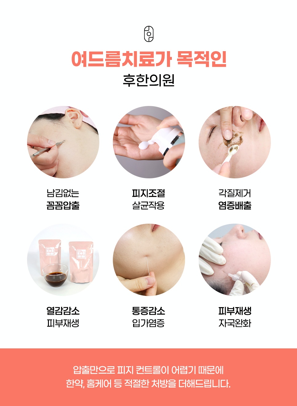 후한의원 여드름 치료 구성 요소 6가지