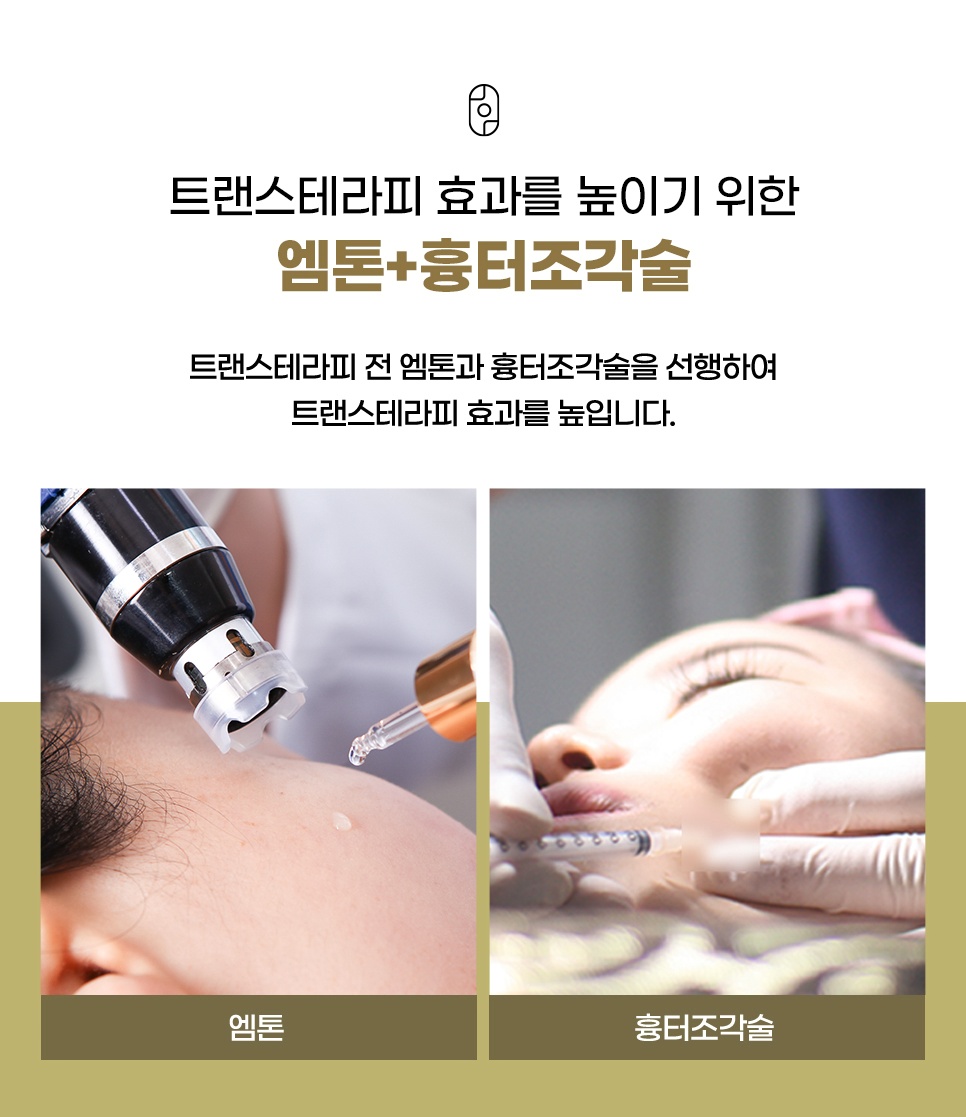 트랜스테라피 전 엠톤과 흉터조각술 선행 시술 장면