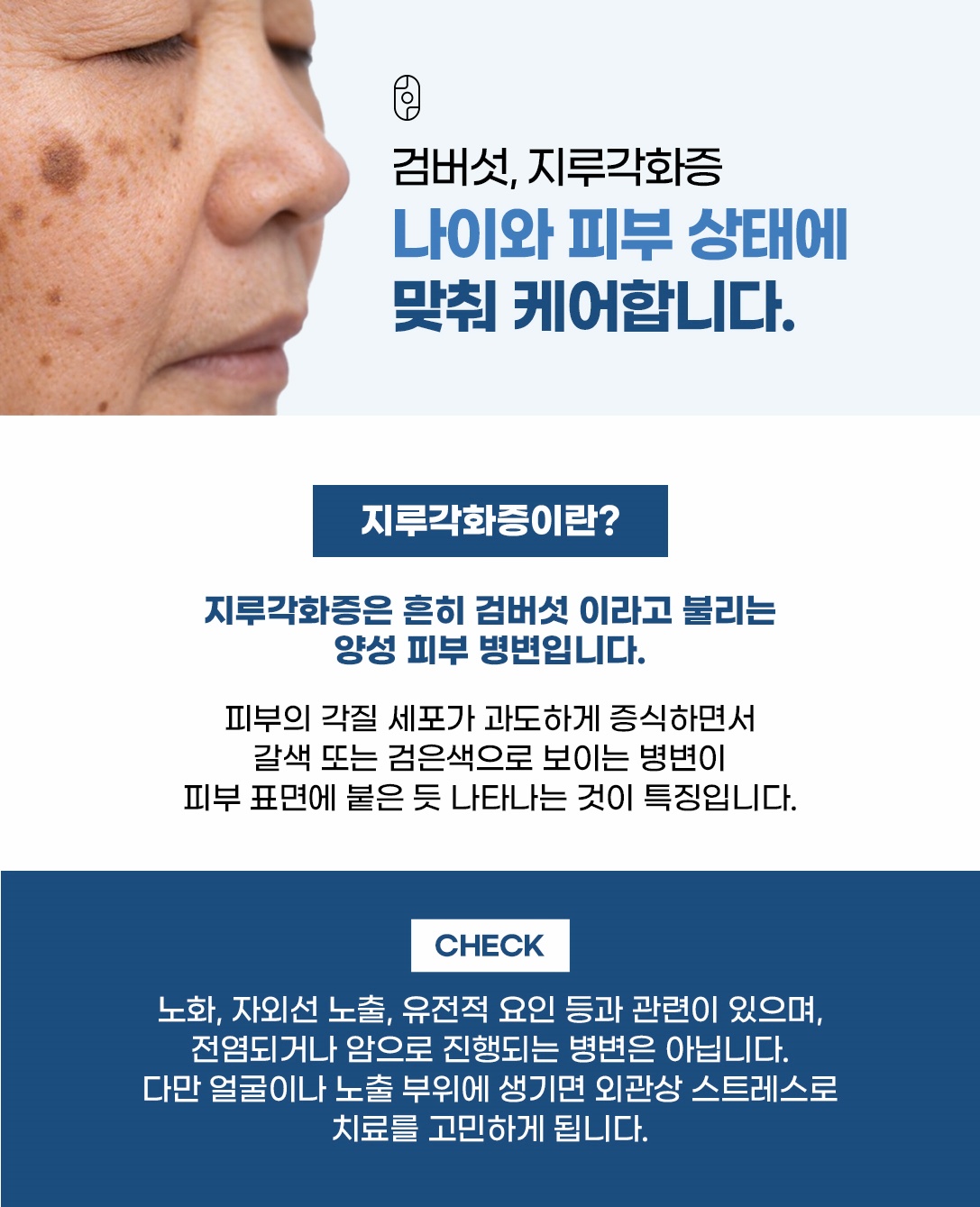 검버섯이라 불리는 지루각화증, 나이·피부 상태별 맞춤 케어 소개