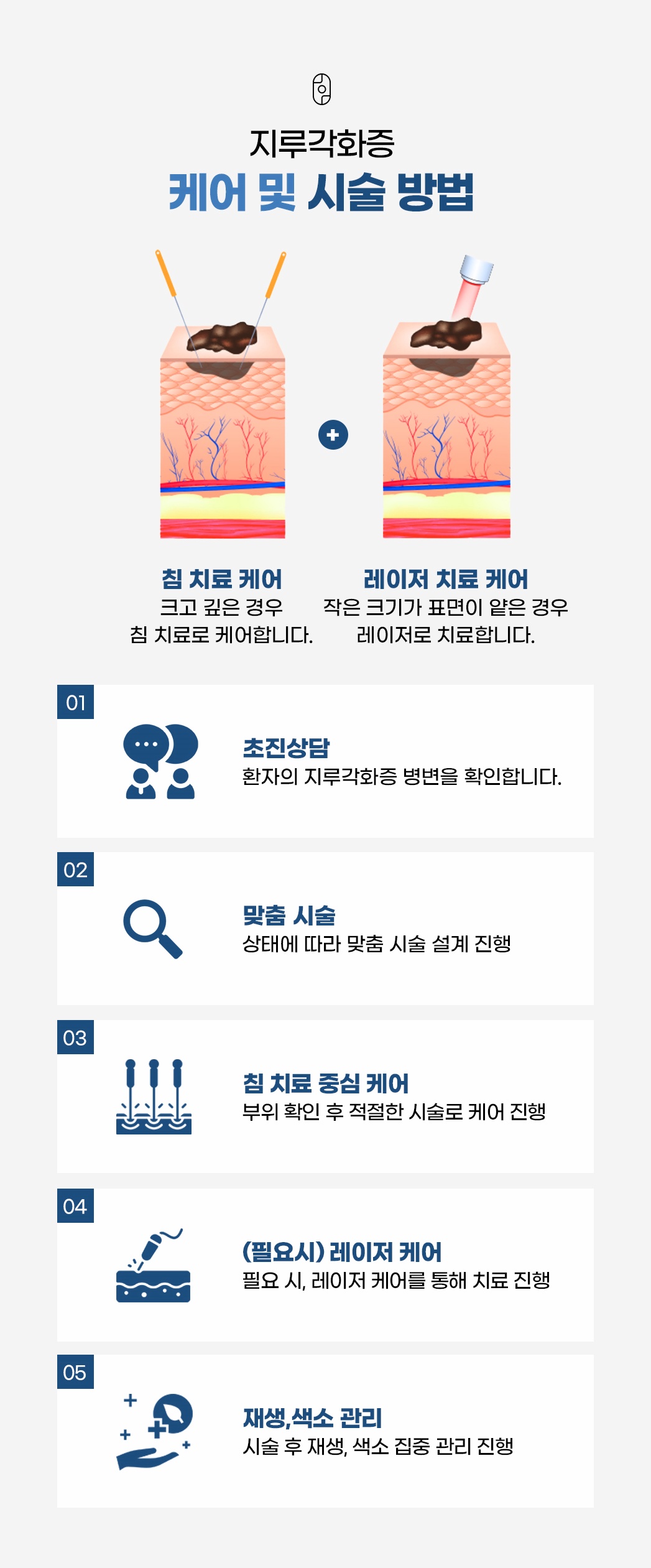 크기와 깊이에 따라 침 치료와 레이저 치료로 나누는 지루각화증 케어 단계