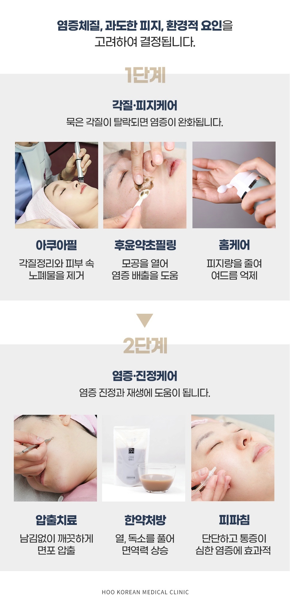 아쿠아필 약초필링 면포압출 피파침 등 단계별 여드름 한방 케어 솔루션