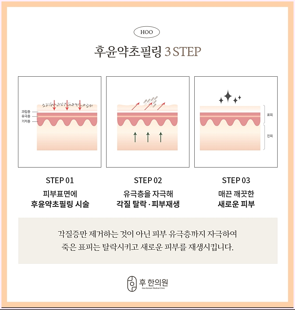 약초필링 시술 단계 이미지