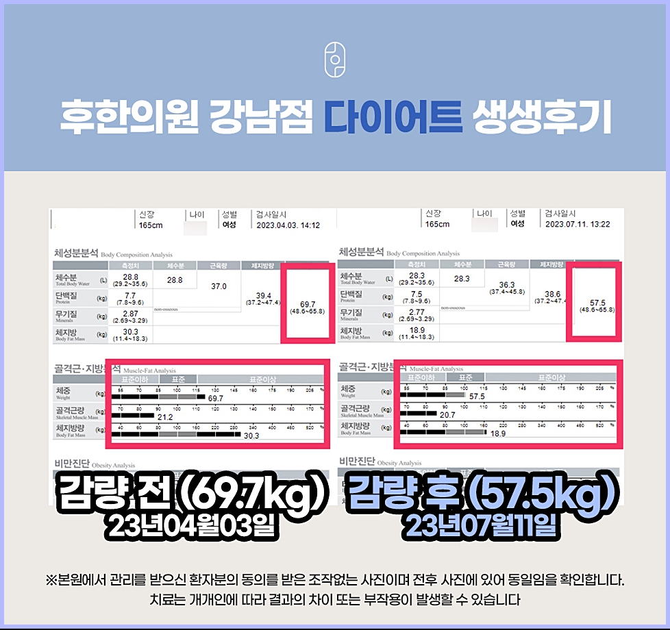 후한의원 강남 다이어트 전후 후기