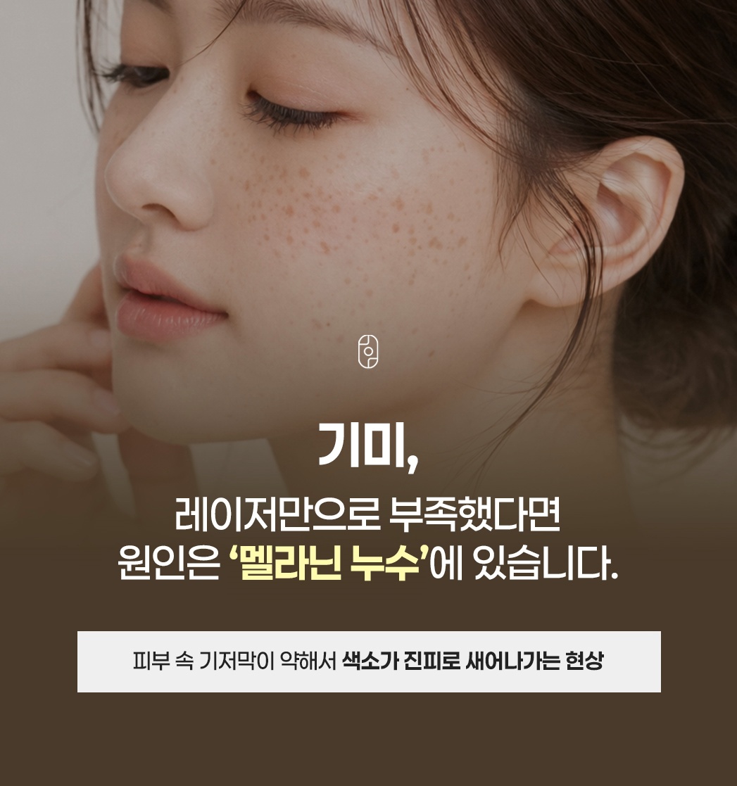 눈가에 퍼진 갈색 주근깨와 기미 피부 사진