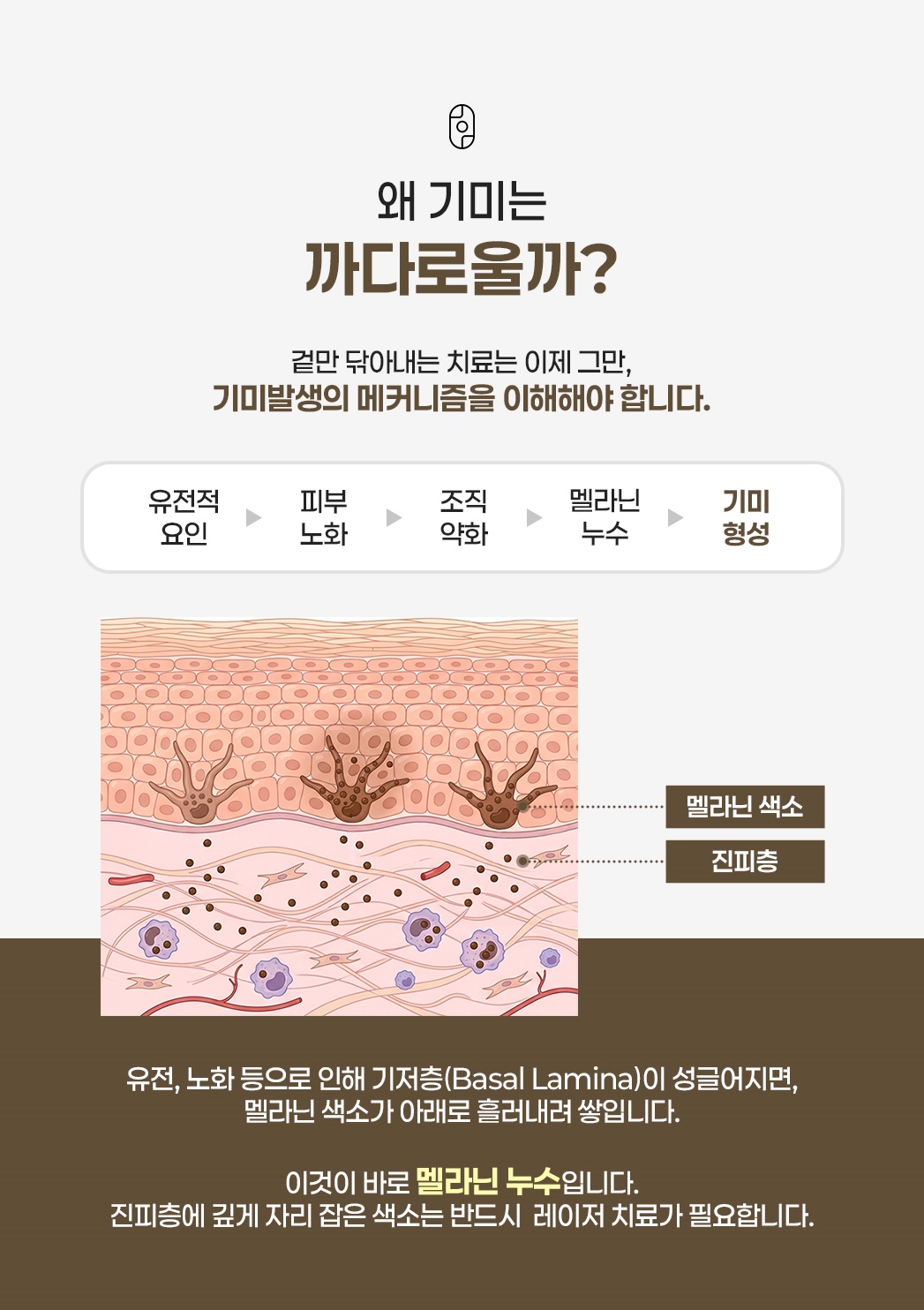 유전·피부 노화로 기저층이 약해져 멜라닌이 진피로 새는 기미 발생 과정