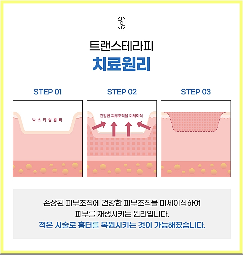체계적으로 진행되는 트랜스테라피 치료 원리