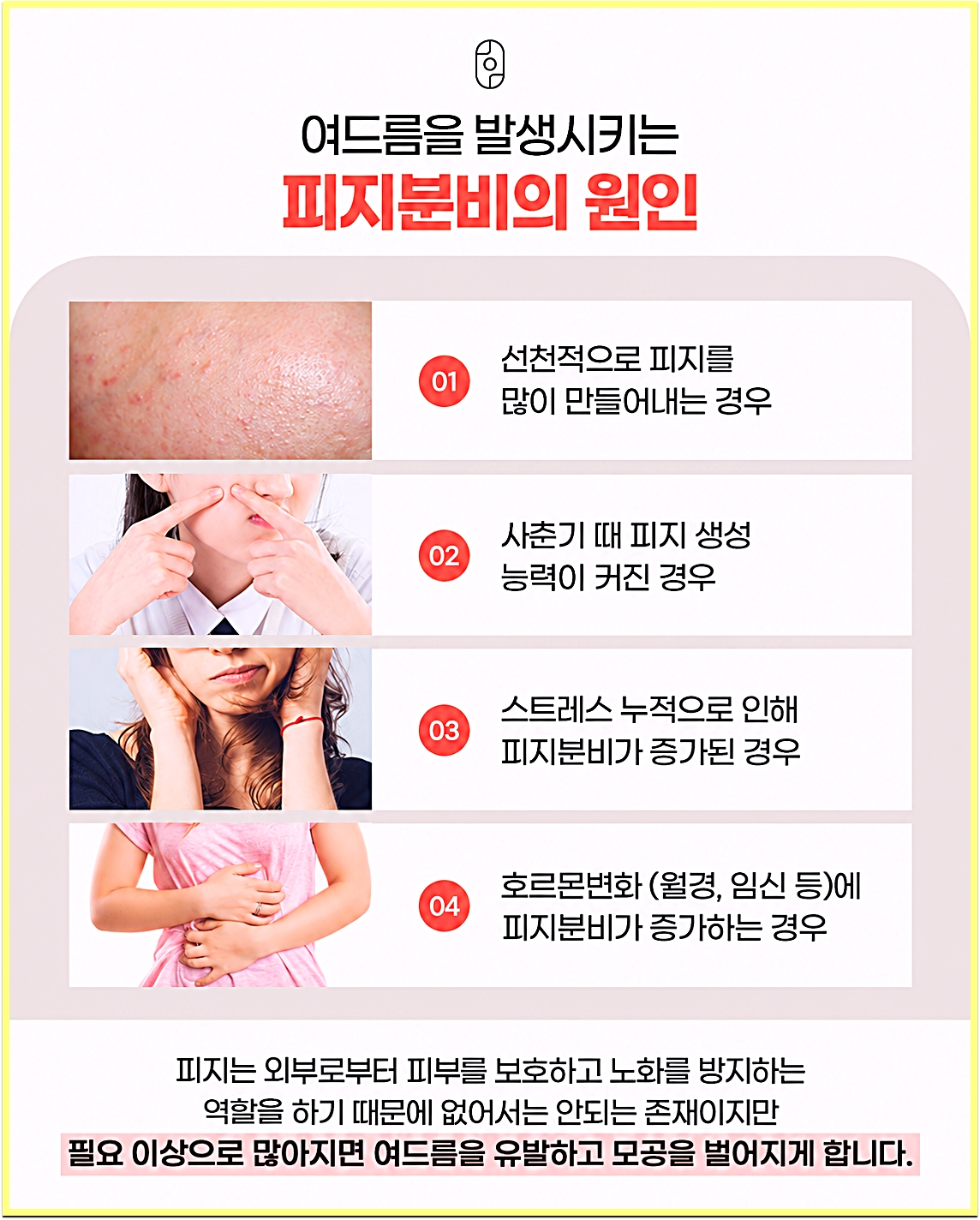 후한의원 강남점 여드름을 발생시키는 피지분비의 원인 네 가지 그래픽
