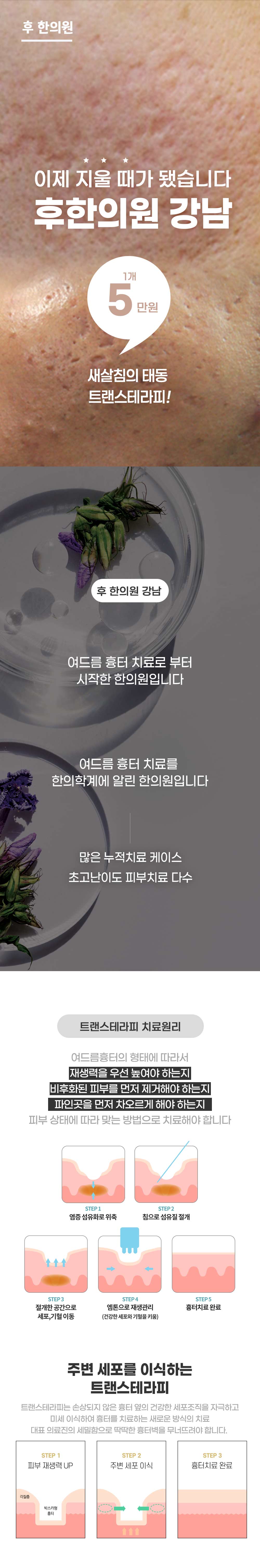 랜딩이미지