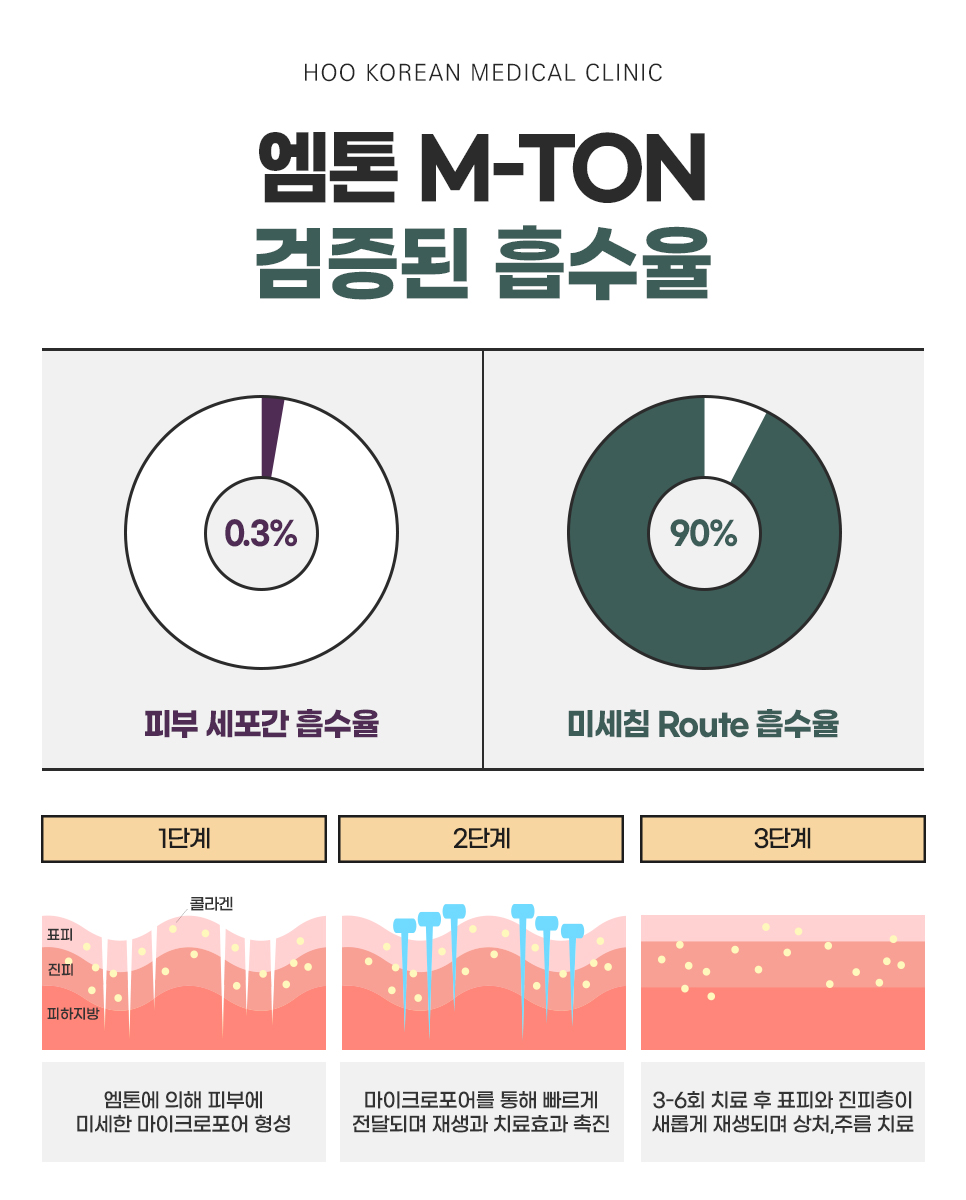 랜딩이미지