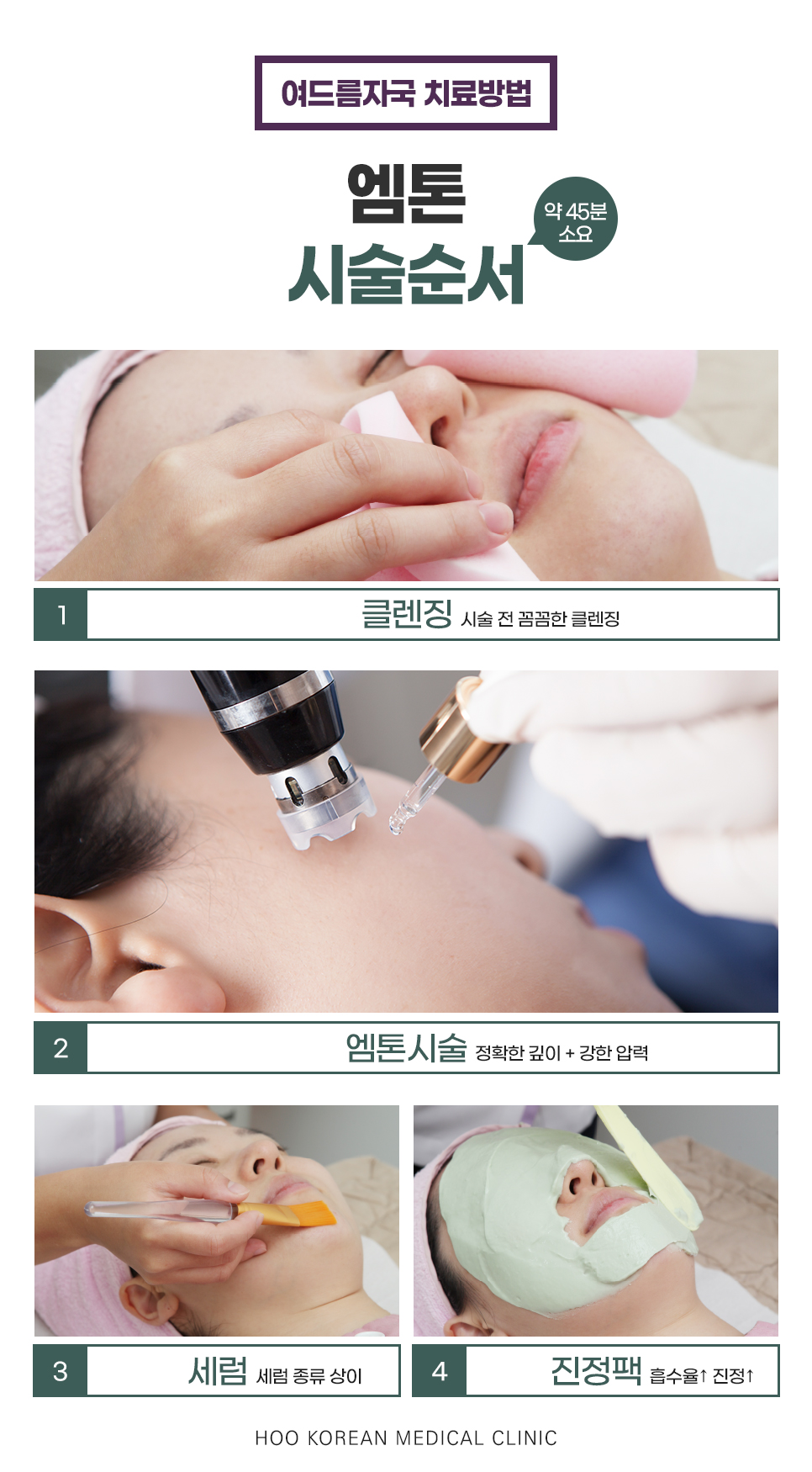 랜딩이미지