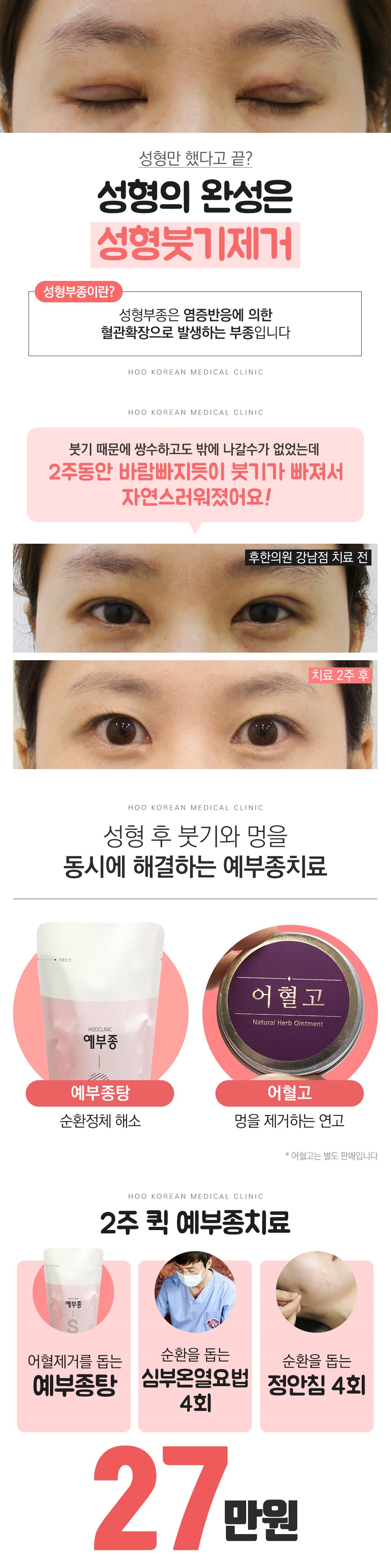 랜딩이미지